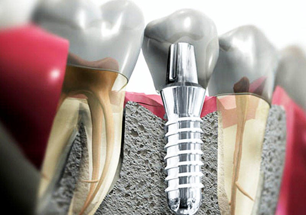 ����������� ����� �������